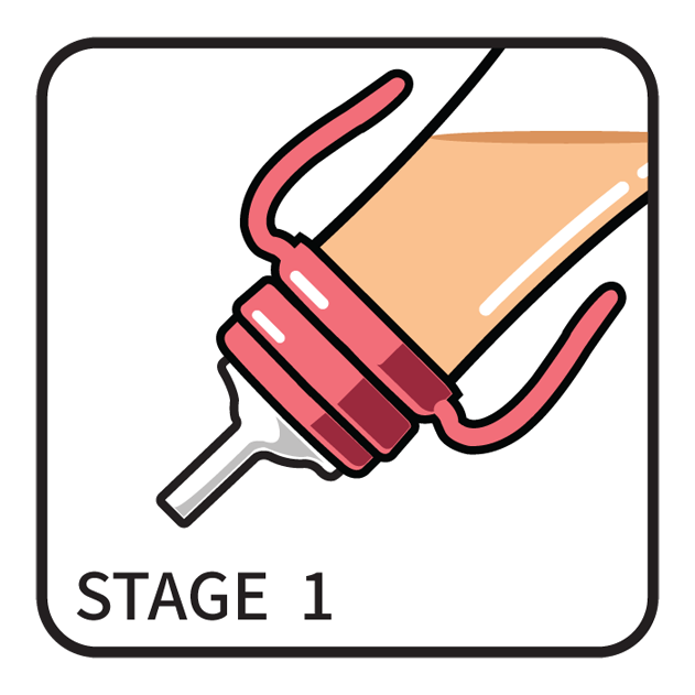 B_STAGE_1.png
