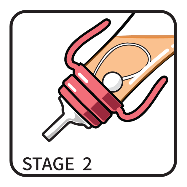 B_STAGE_2.png